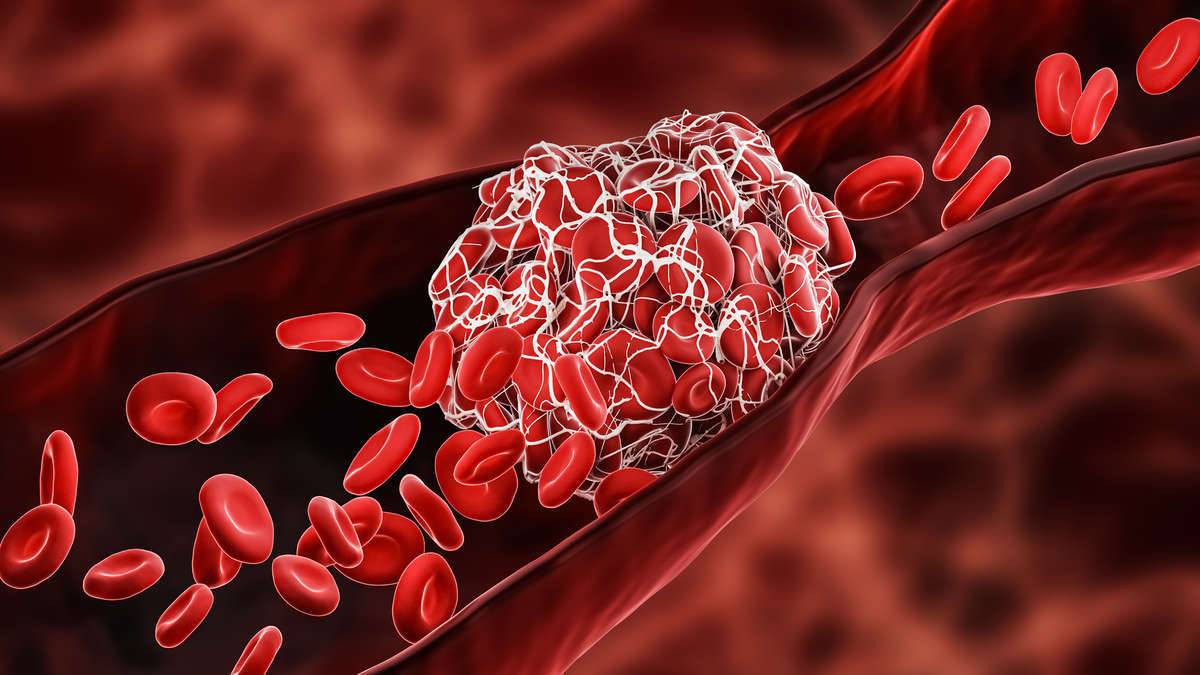 Enzyme für die Thrombusbehandlung von Creative Enzymes.