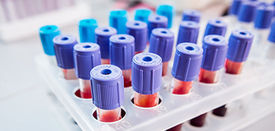 Enzyme für die diagnostische Forschung