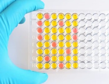 Enzymaktivitätsmessung für Oxidoreduktasen, die auf CH-CH2-Gruppen mit einem Eisen-Schwefel-Protein als Akzeptor wirken