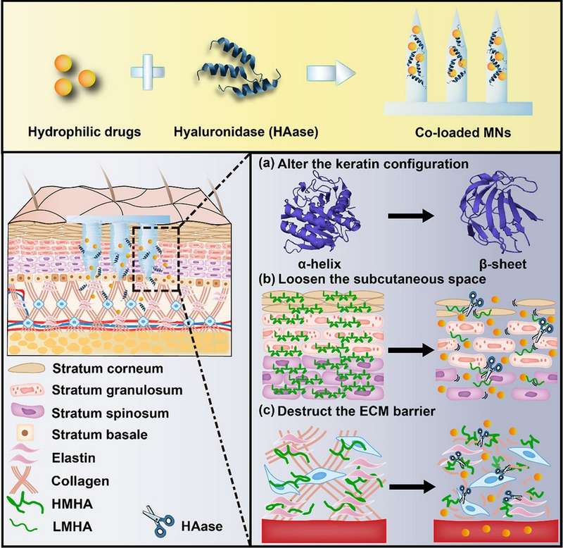 Mechanismen von Hyaluronidase zur Verbesserung der transdermalen Abgabeeffizienz: Änderung der Keratinstruktur, Lockerung des subkutanen Raums und Zerstörung der ECM-Barriere.