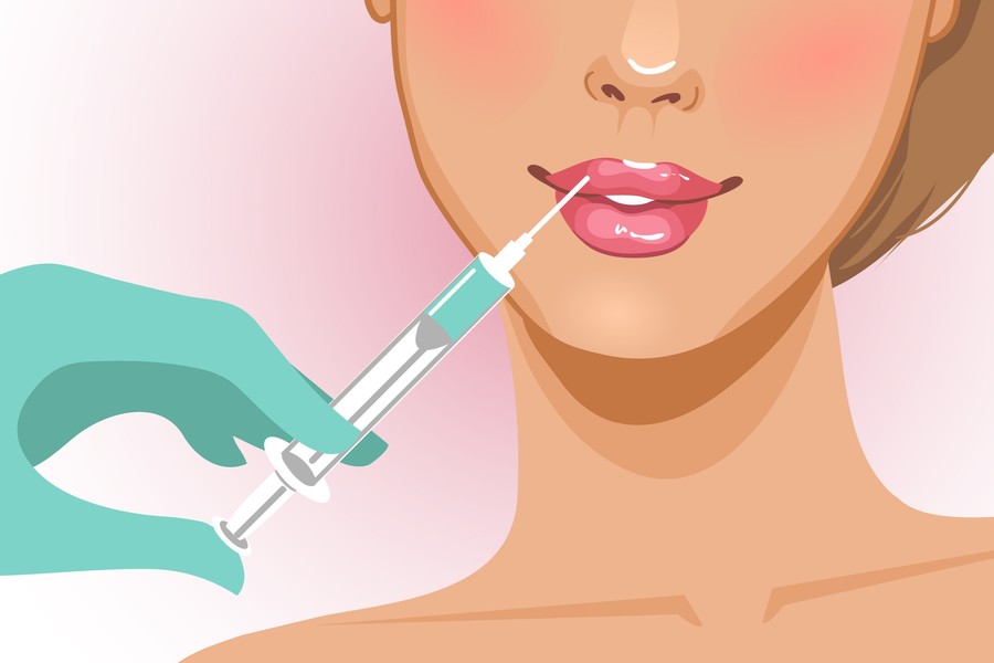 Lösen von Lippenfüllern mit Hyaluronidase: Wie viele Einheiten werden benötigt?