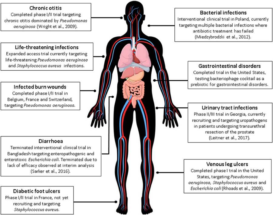 Zusammenfassung der menschlichen Phagentherapiestudien, einschließlich chronischer Ohrinfektionen, bakterieller Infektionen, lebensbedrohlicher Infektionen, gastrointestinaler Störungen und mehr.