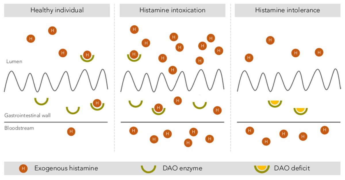 Intestinale Abbau von Histamin durch das DAO-Enzym bei einer gesunden Person, bei Histaminintoxikation und bei Histaminintoleranz.