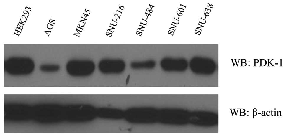 Expression der Pyruvatdehydrogenase-Kinase 1 im Magenkarzinom als potenzielles therapeutisches Target