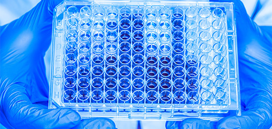Creatinase/Creatininase/Sarcosinoxidase