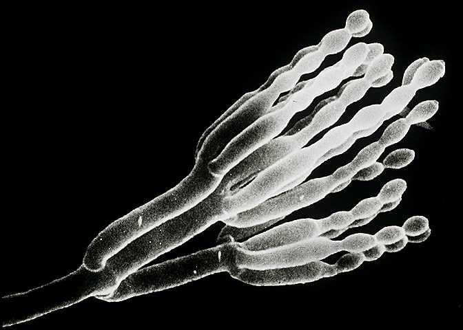 Enzymatische Aktivitätsmessung für L-Arabinitol-2-Dehydrogenase unter Verwendung spektrophotometrischer Assays