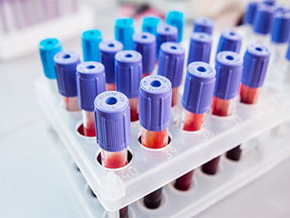 Ausgewählte Enzymprodukte für diagnostische Anwendungen