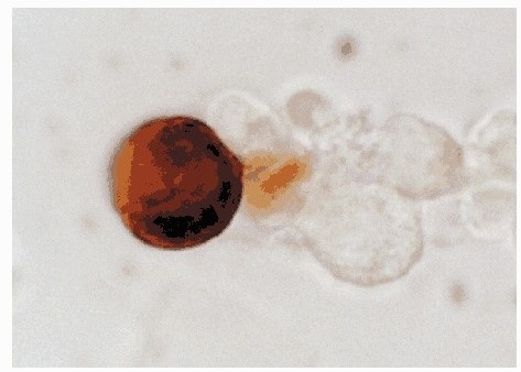 Immunfärbung von Renin-Protein in einer JGC unter Verwendung von Kaninchen-Anti-Maus-Renin-Antikörper