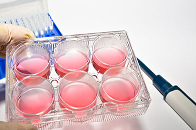 Trypsin und Chymotrypsin